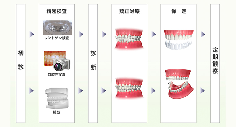 歯列矯正の流れ